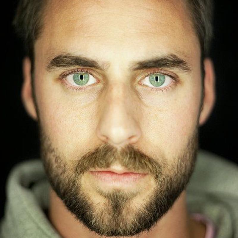 Glaucoma (12 months) colored contact lenses